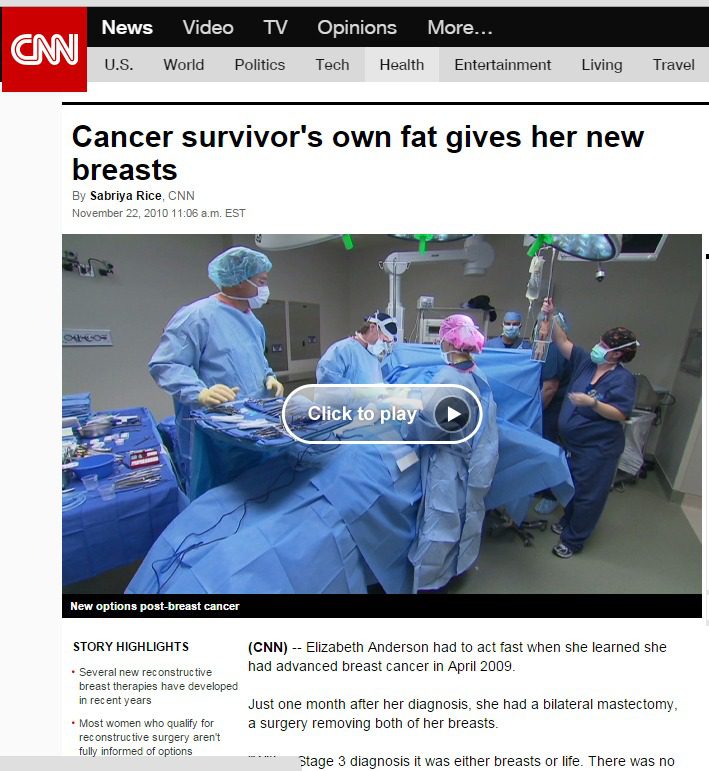 CNN Cancer survivor's own fat gives her new breasts