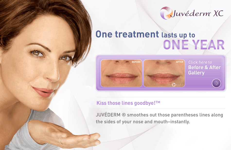 Juvederm Injectable Filler for Facial Rejuvenation - Fiala Aesthetics